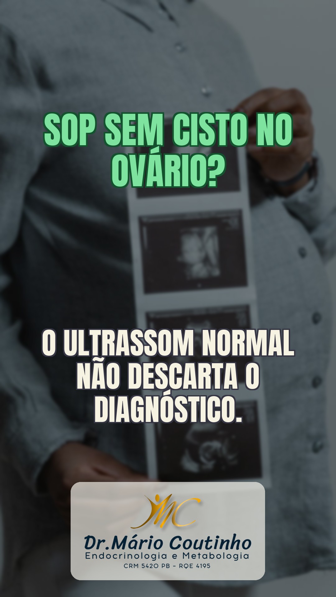 SOP sem cisto no ovário? Entenda os reais critérios