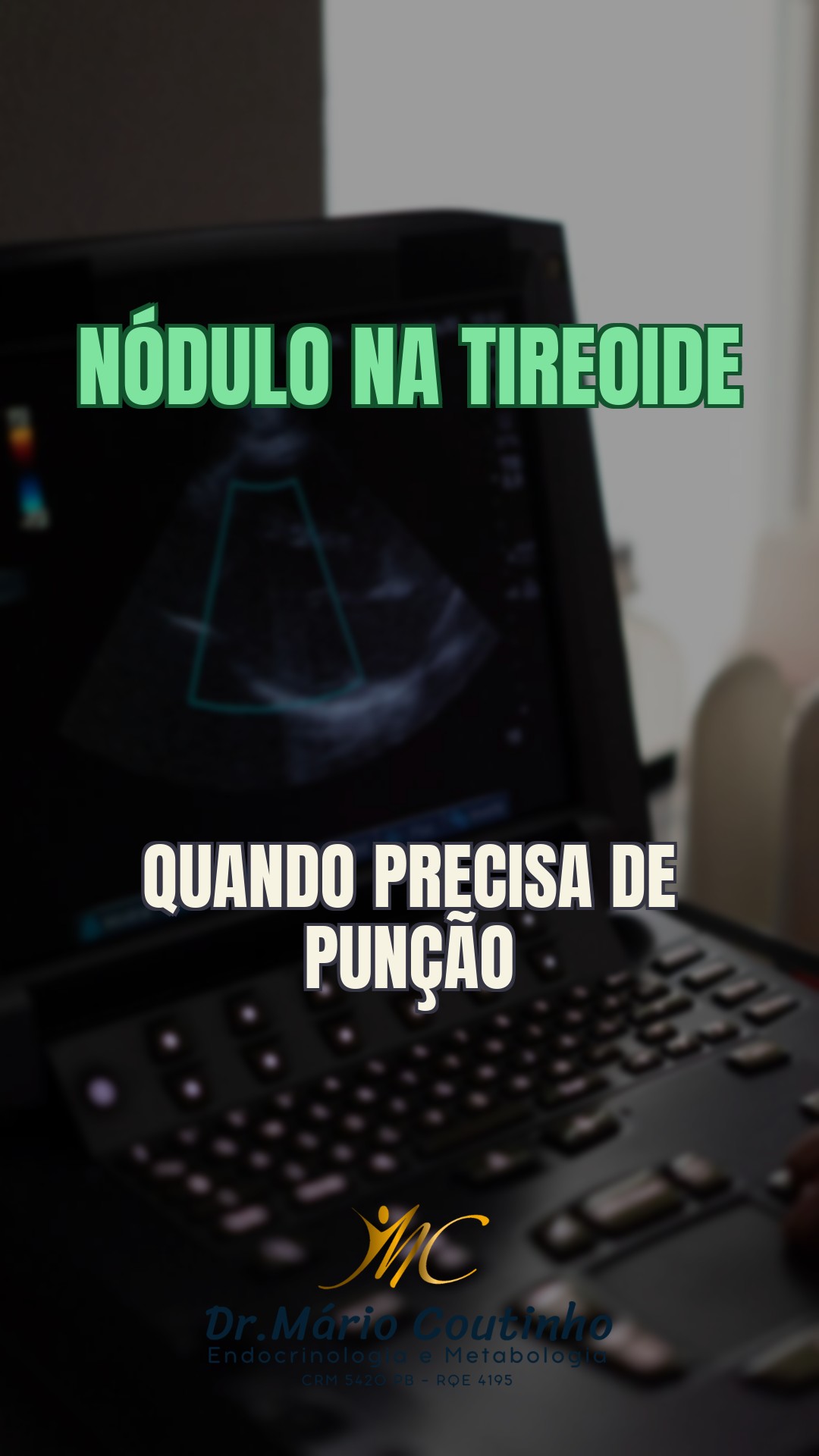 Nódulo na tireoide: quando é preciso fazer punção?
